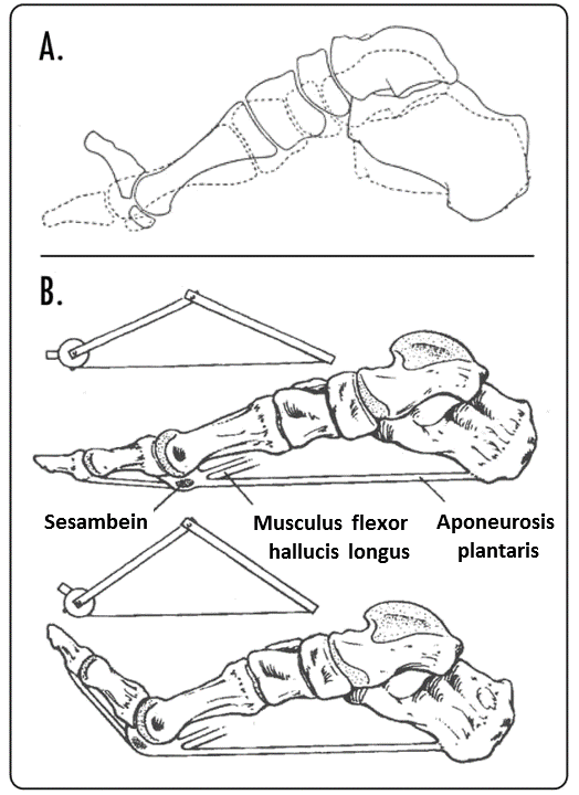 The effect of dorsiflexing the toes on arch height (A). The windlass mechanism (B).