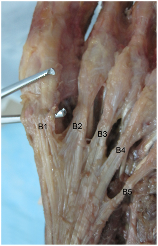 Figure 2. Five central part plantar aponeurosis bundles.