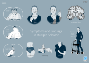 Symptoms and Findings in Multiple Sclerosis
