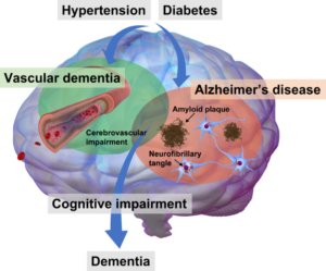 Vascular risk factors, cognitive decline, and dementia.