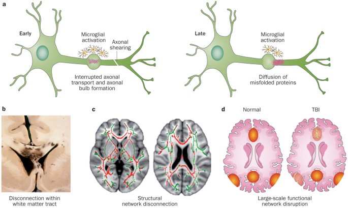Figure 2: Effects of TBI across spatial scales.
