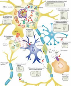 ALS Disease Pathology and Proposed Disease Mechanisms.