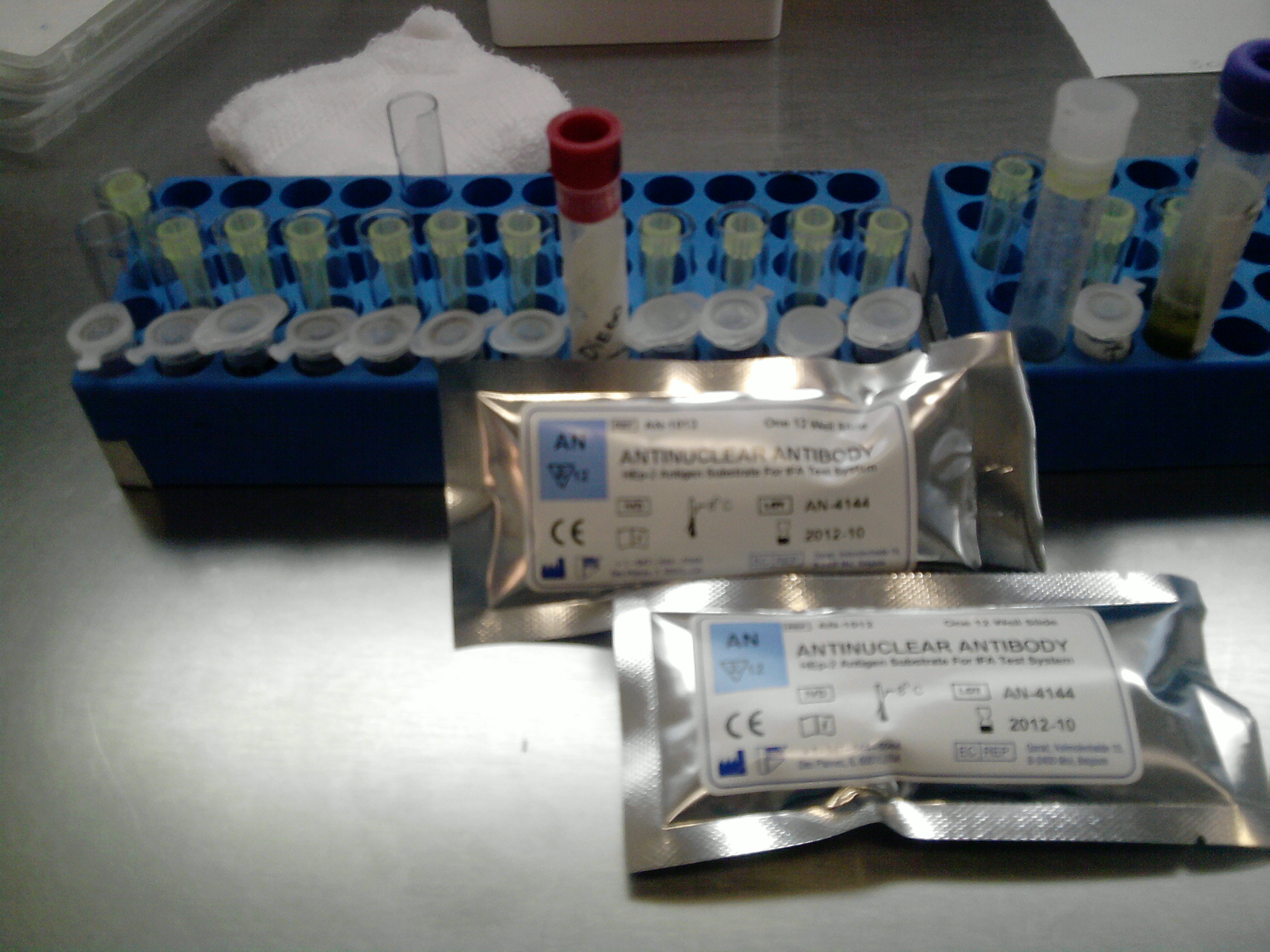 Common autoimmune disease diagnostic tool: antinuclear antibody