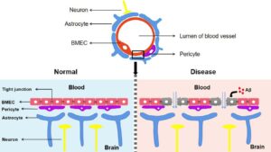 Dysfunction of the blood brain barrier in Alzheimer's Disease.