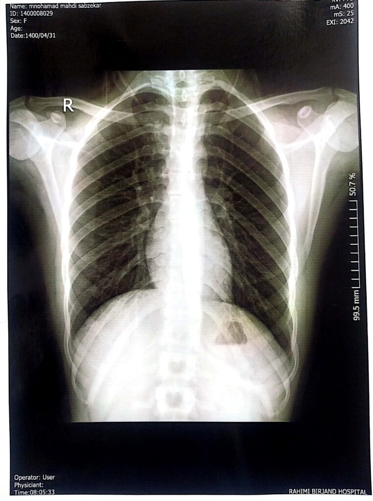 Example of an x-ray