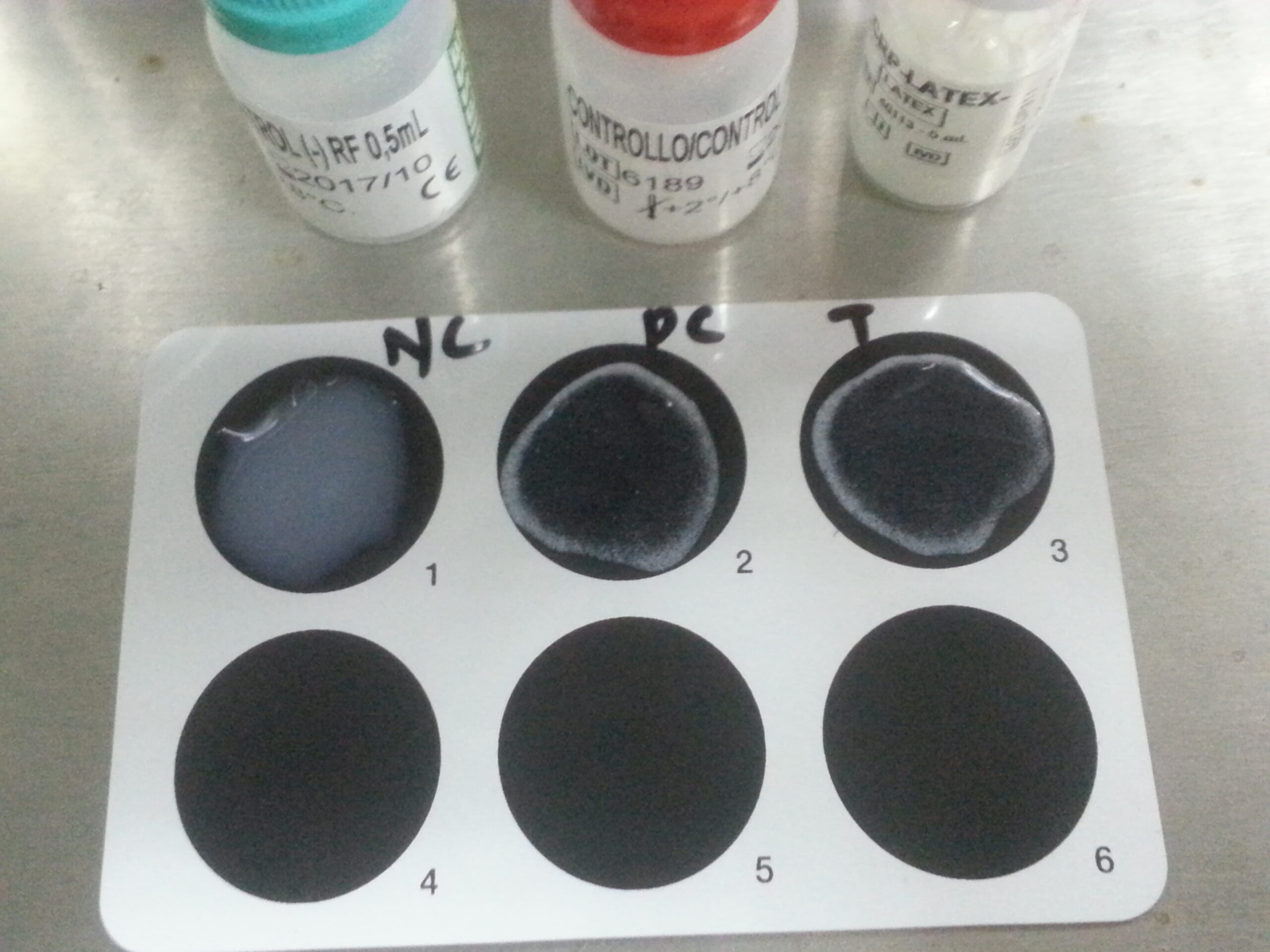 Common autoimmune diseases - diagnostic tool