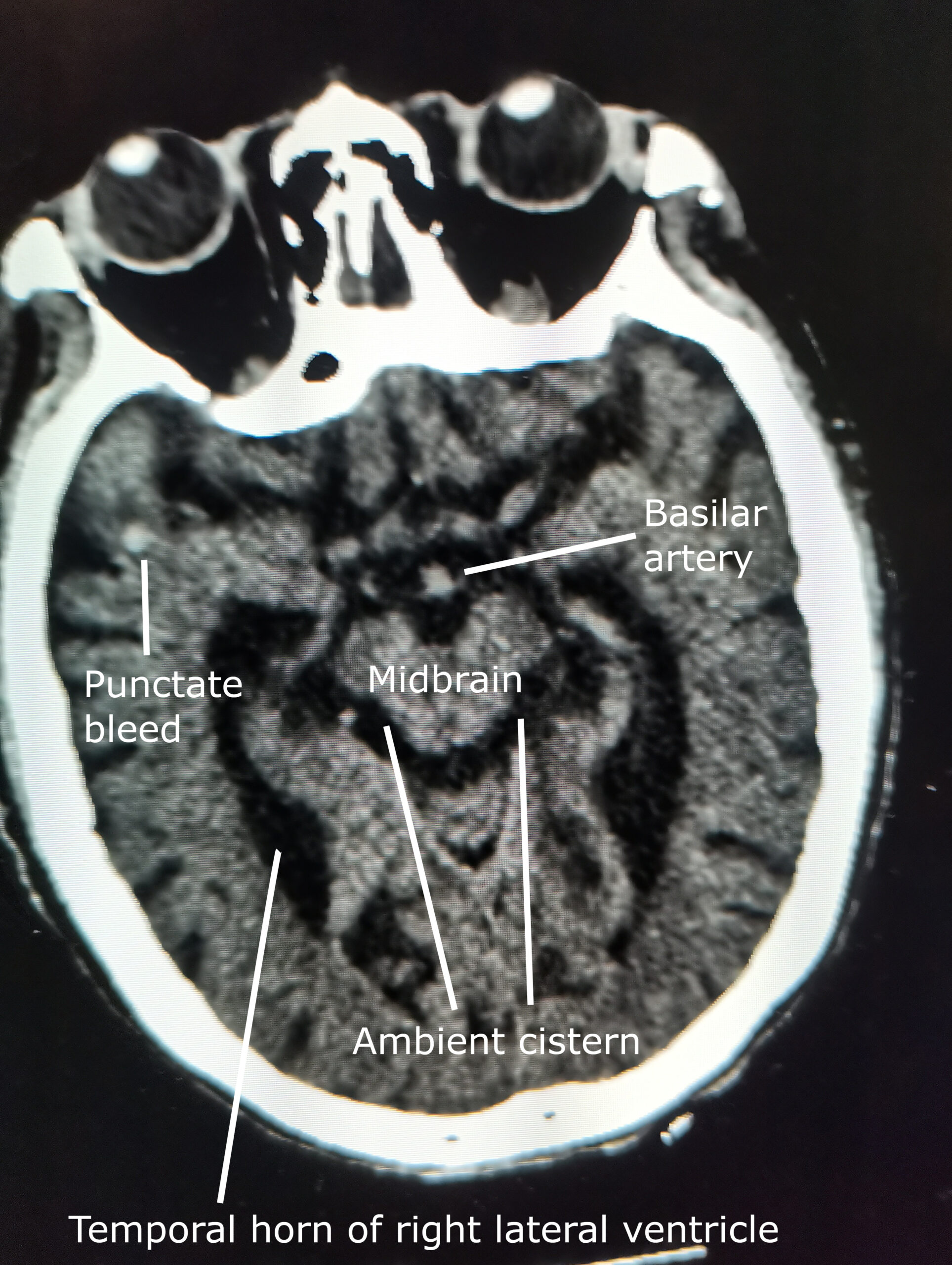 Image of a CT scan