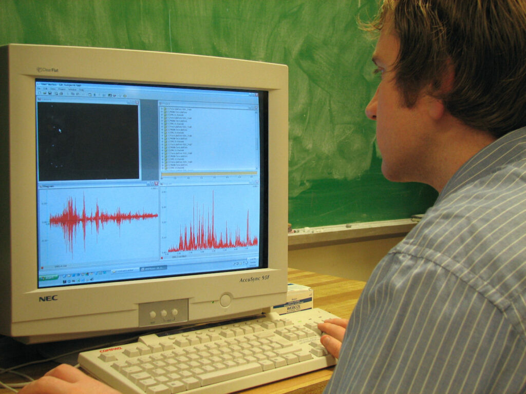 Diagram of electromyogram
