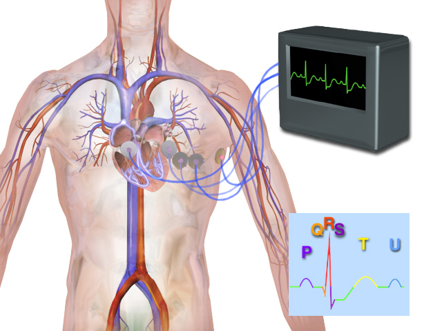 Diagram of electromyogram