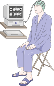 Diagram of an electroencephalogram (EEG)