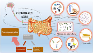 Gut-Brain Axis of Parkinson's Disease.