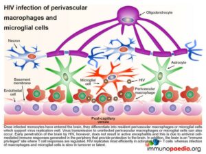 HIV infection of perivascular macrophages and microglial cells.