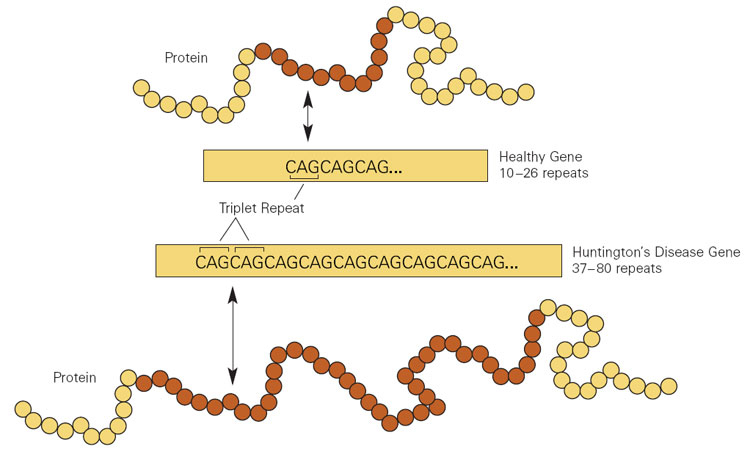 Example of abnormal protein preparation: Huntington's disease