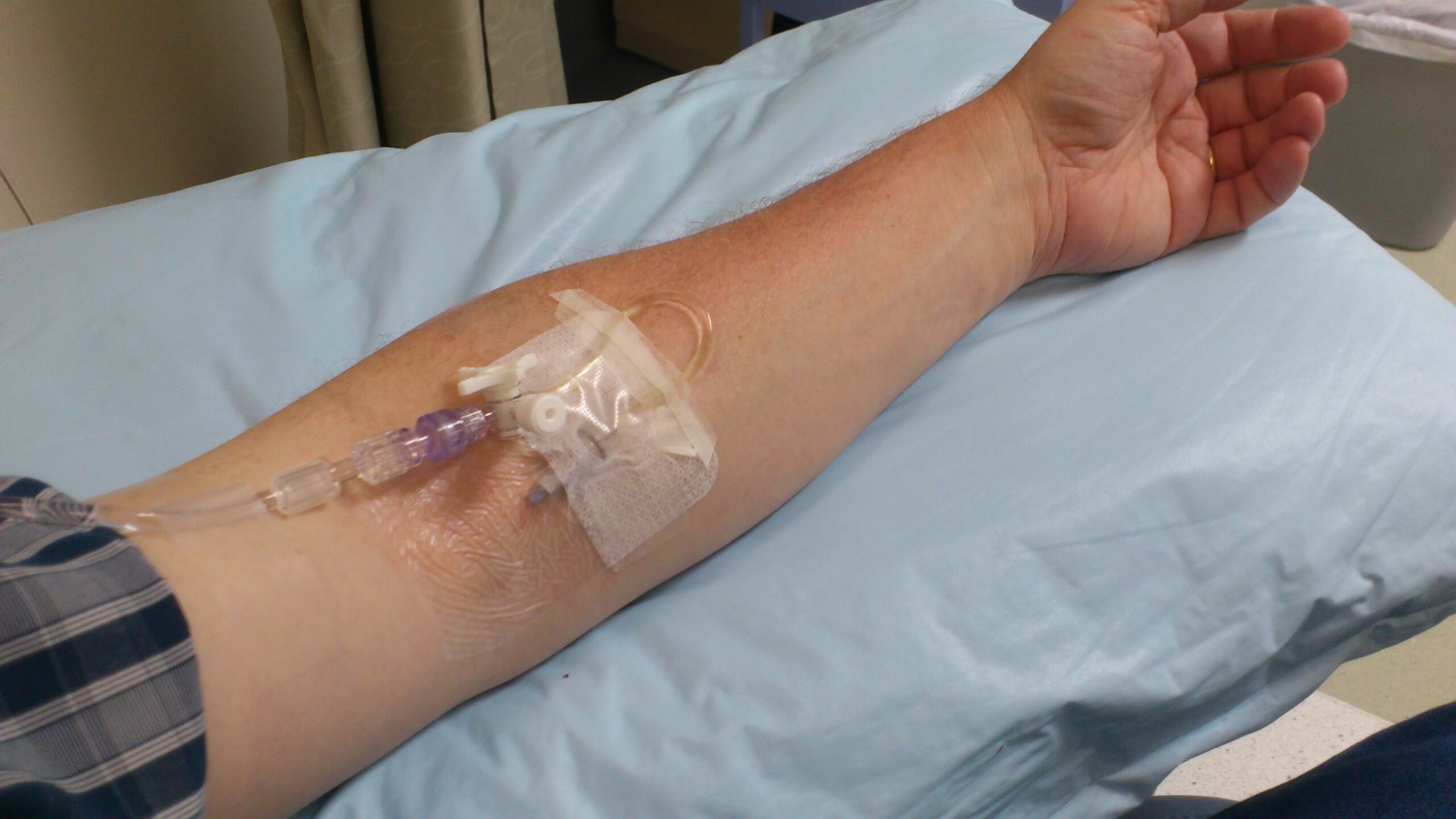 An Intragam infusion (intravenous immunoglobulin replacement) as treatment for Common Variable Immunodeficiency (CVID). CVID is a genetic condition that weakens the immune system due to low antibody levels. As such, patients with CVID typically experience frequent infections and therefore require lifelong treatment.