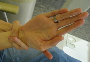 Marfan syndrome