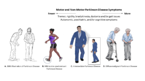 The new modern image of Parkinson's includes many different clinical presentations and includes all genders and cultures (Author Michael S. Okun and Artist Erica Rodriguez).