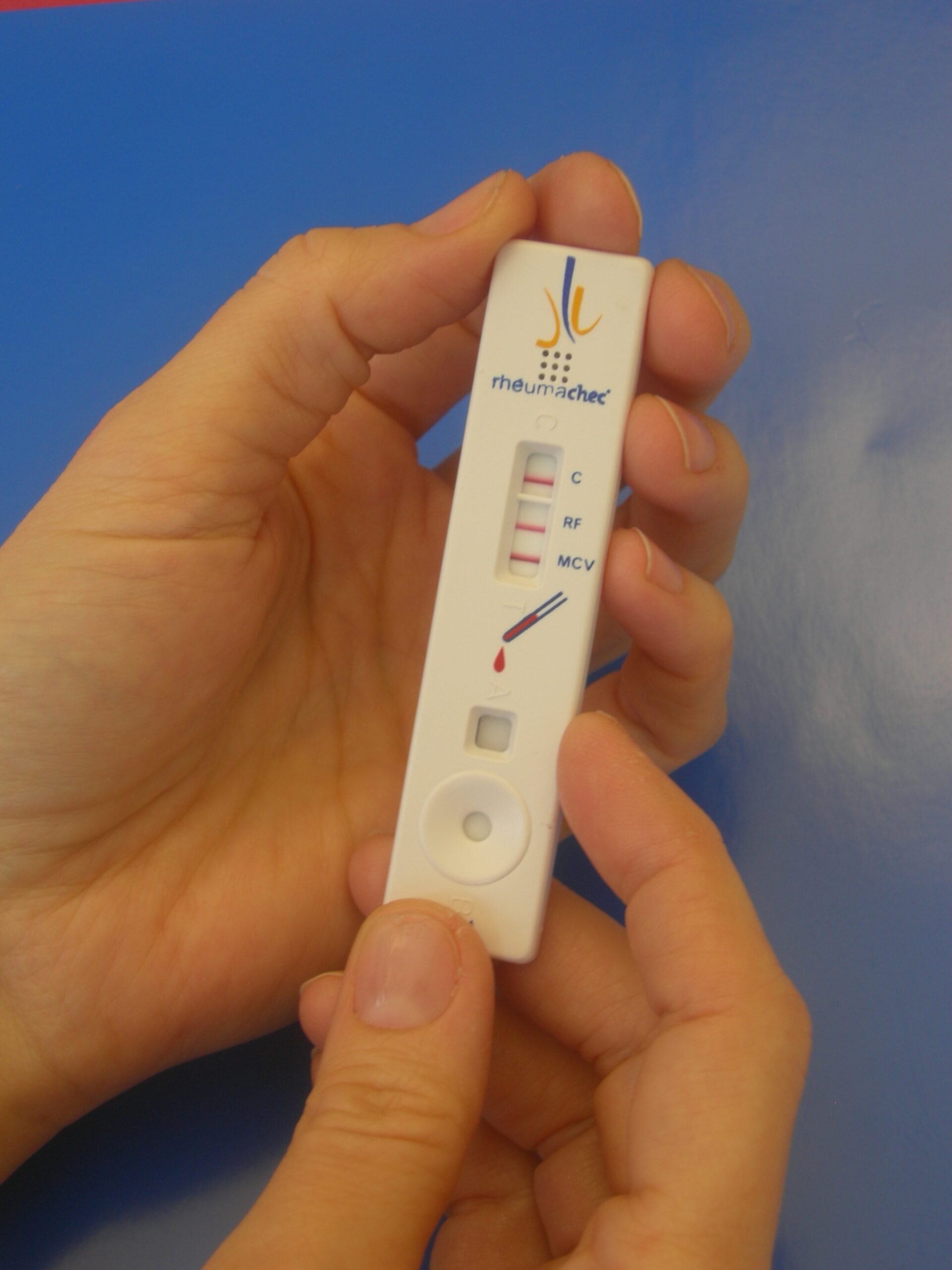 Early detection of rheumatoid arthritis