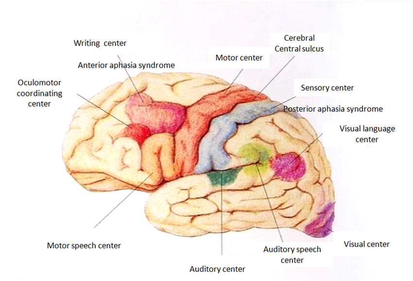 PSA “anterior and posterior dichotomy”. Localization of the cerebral central sulcus. PSA, post‐stroke aphasia.