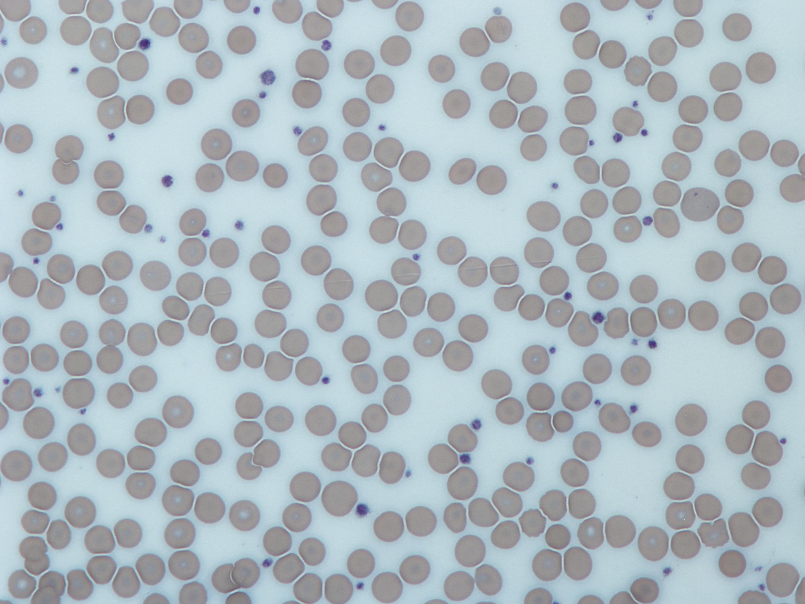 Platelets in a Giemsa-stained blood film.