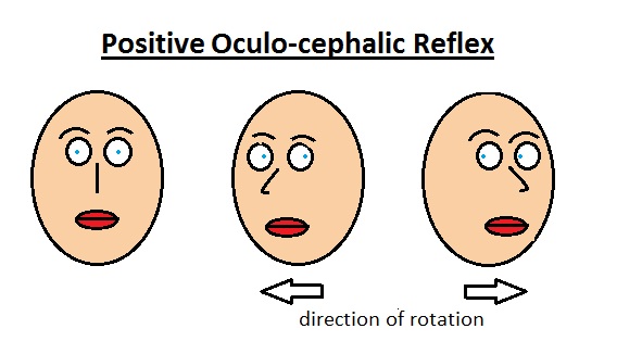 Oculo-cephalic Reflex