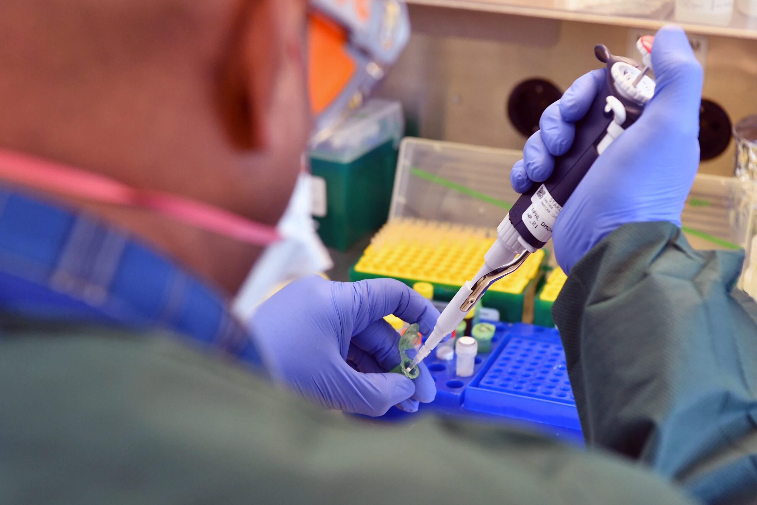 Preparation of RT-PCR Reaction for rapid and sensitive diagnosis.