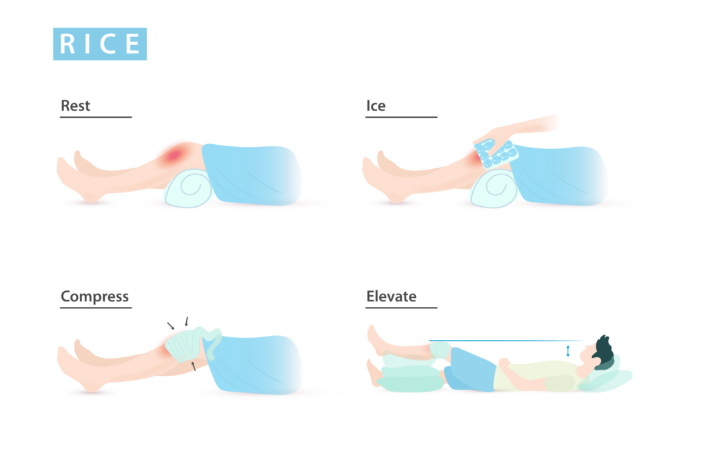 RICE: rest, ice, compression, and elevation
