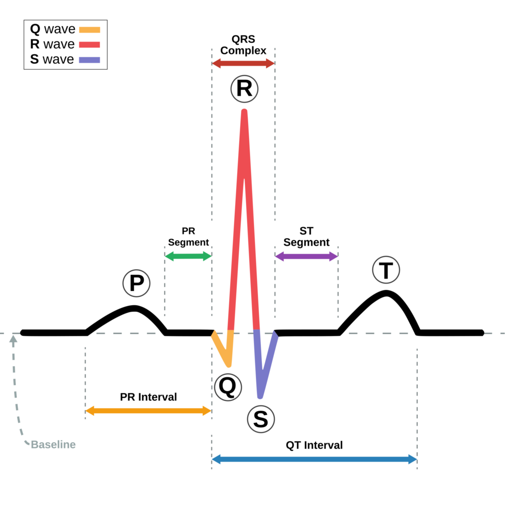 Diagram of sinus rhythm during electrocardiogram
