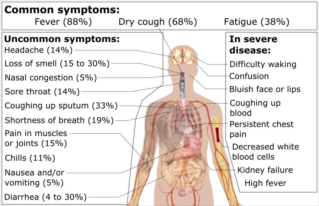 The symptoms of COVID-19. The frequency of symptom appearance is in brackets for common and uncommon symptoms.