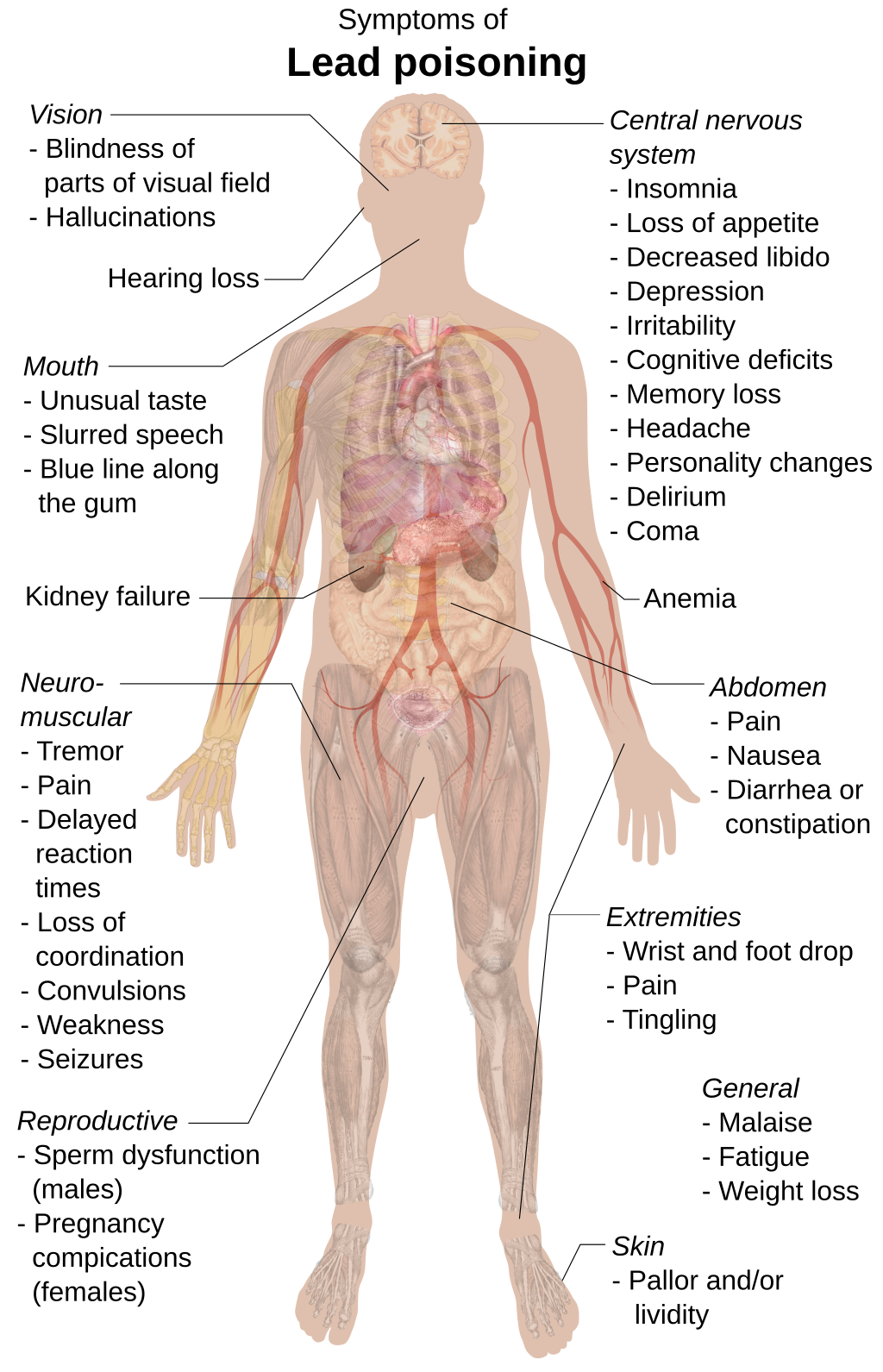 Symptoms of lead poisoning.