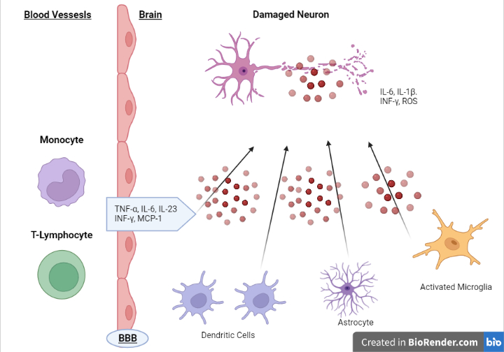 TBI Neuroinflammation