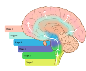 The prion hypothesis in Parkinson’s disease, Braak to the future.