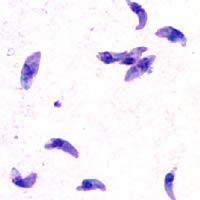 Toxoplasma gondii tachyzoites - teratogen