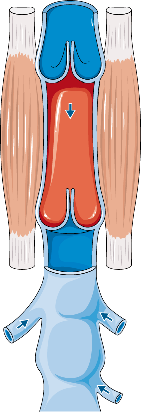 Venious Return Figure 1