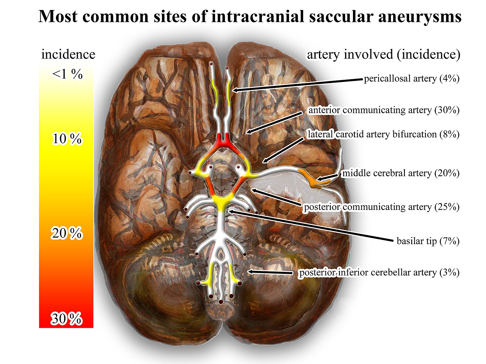 Intracranial aneurysms - inferior view - heat map.