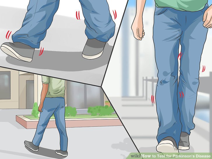 Recognizing Symptoms of Parkinson’s Disease