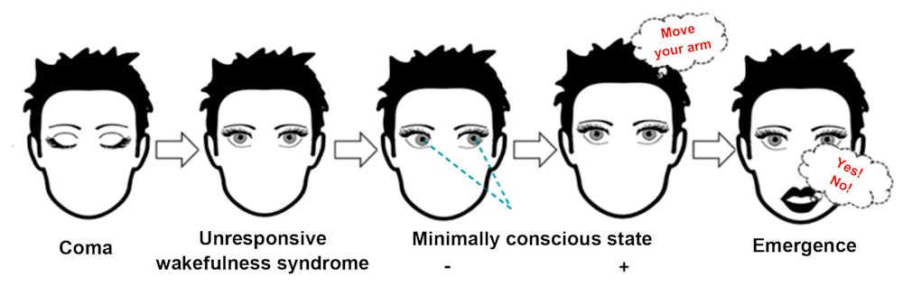 Diagnosis of the state of consciousness following brain damage: coma, unresponsive wakefulness syndrome (vegetative state), minimally conscious state minus, minimally conscious state plus and emergence. Wislowska et al. (2017). Night and day variations of sleep in patients with disorders of consciousness