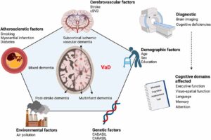 Scheme illustrating the continuum of risk factors that contribute to VaD etiology.