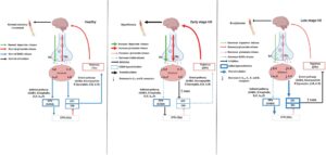 Signaling pathways involved in stages of Huntington’s disease.