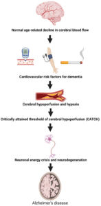 The vascular hypothesis of Alzheimer’s disease.
