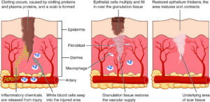 Tissue healing