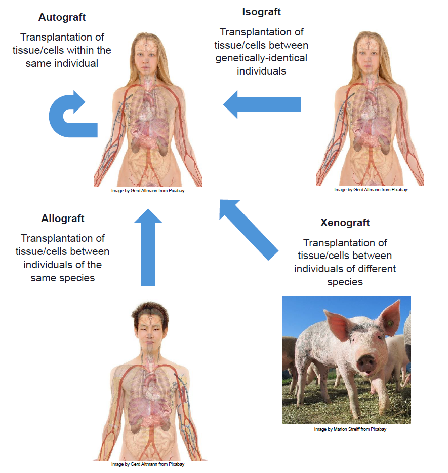 Four types of transplants: Autograft, Allograft, Isograft, and Xenograft.