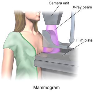 Mammogram: A specialized X-ray used for early breast cancer detection, often before any symptoms appear. Current recommendations for average-risk individuals are for mammogram every two year, starting at age 40.