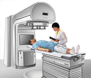 External Beam Radiotherapy can deliver beams of radiation that are guided by imaging (CT, MRI or PET scans). Often the radiation beams in form of either high-energy x-rays or gamma rays), are aimed at the tumor from several directions to minimize irritation of the surrounding tissue and skin at the point of entry.