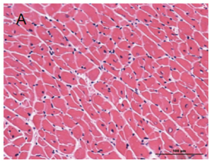 Normal, healthy myocardiocytes with nuclei staining dark purple with H&E dye.