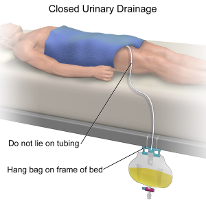 Urinary Catheterization