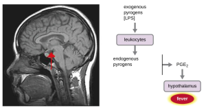 The role of the hypothalamus in the inflammatory response, fever. The activation of leukocytes during an infection or injury can result in the release of endogenous pyrogens (e.g., a set of cytokines including specific interleukins) which trigger the production of prostaglandin E2 (PGE2) which resets the hypothalamus, the body's thermostat, to initiate fever. Gram-negative bacteria have lipopolysaccharide (LPS) capsule, which is considered an endotoxin and an exogenous pyrogen, which causes WBCs to produce more of these pyrogens. Some pathogen can lead to high levels of pyrogens being released which can cause dangerously high spiking fevers.