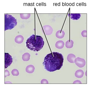 Mast Cells are granulocytes and function similarly to basophils by inducing and promoting inflammatory responses. This figure shows mast cells in blood. In a blood smear, they are difficult to differentiate from basophils. Unlike basophils that circulate the bloodstream, mast cells migrate from the blood in to patrol various tissues.