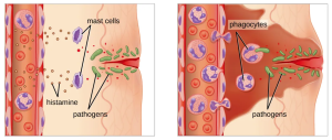 (a) Mast cells detect injury to nearby cells and release histamine, initiating an inflammatory response. (b) Histamine increases blood flow to the wound site, and increased vascular permeability allows fluid, proteins, phagocytes, and other immune cells to enter infected tissue. These events result in the swelling and reddening of the injured site, and the increased blood flow to the injured site causes it to feel warm. Inflammation is also associated with pain due to these events stimulating nerve pain receptors in the tissue.