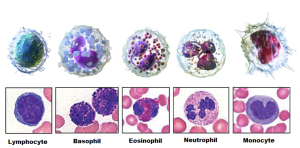 Five types of leukocytes: from left to right, lymphocyte, basophil, eosinophil, neutrophil, and monocytes.