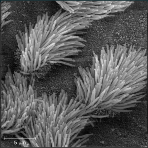 This scanning electron micrograph shows ciliated and non-ciliated epithelial cells from the human trachea. The mucociliary escalator pushes mucus away from the lungs, along with any debris or microorganisms that may be trapped in the sticky mucus, and the mucus moves up to the esophagus where it can be removed by swallowing.